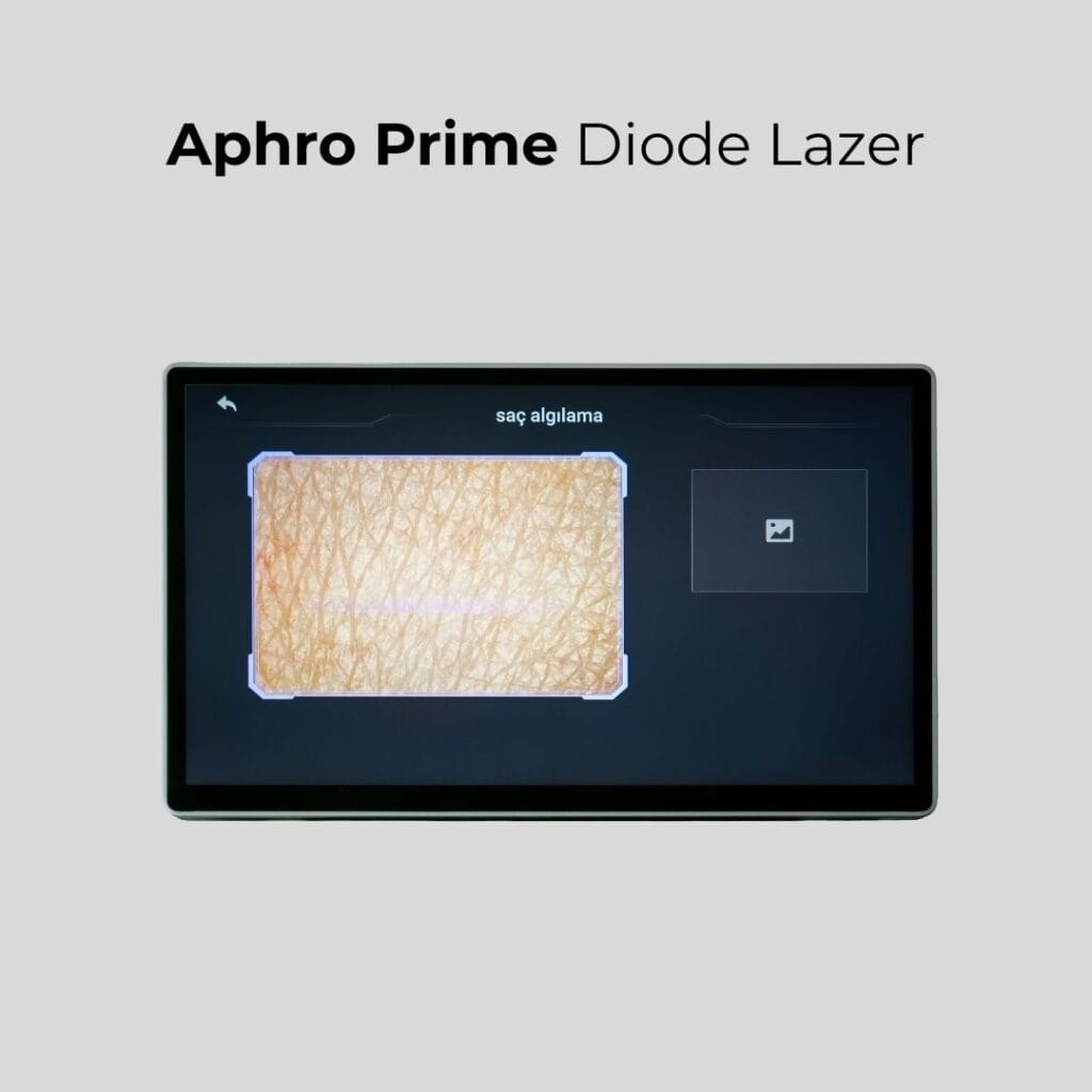 Aphro Prime Cilt Analizi